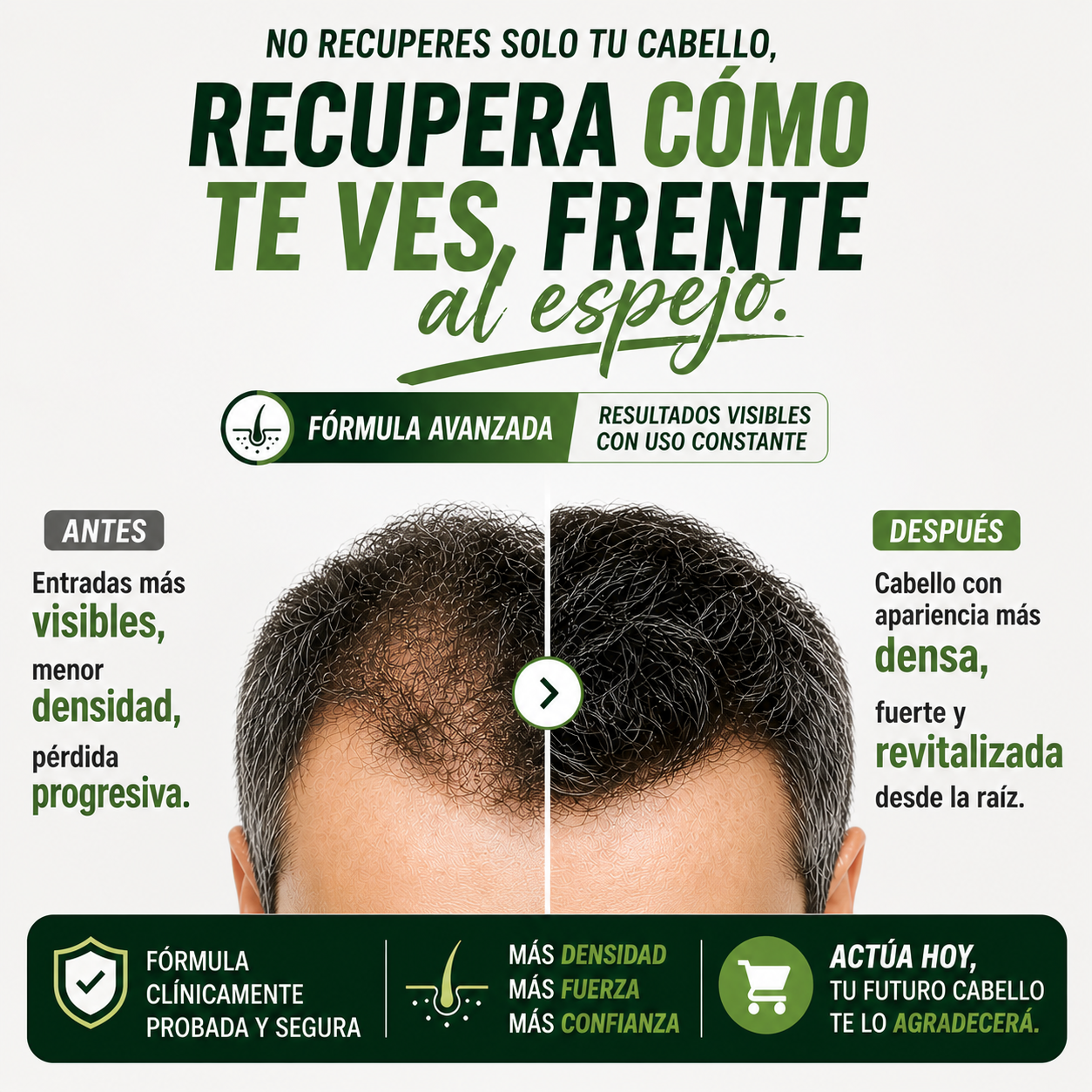 BODYWISE SERUM CAPILAR DE CRECIMIENTO | recupera tu cabello y barba antes de que la caída avance