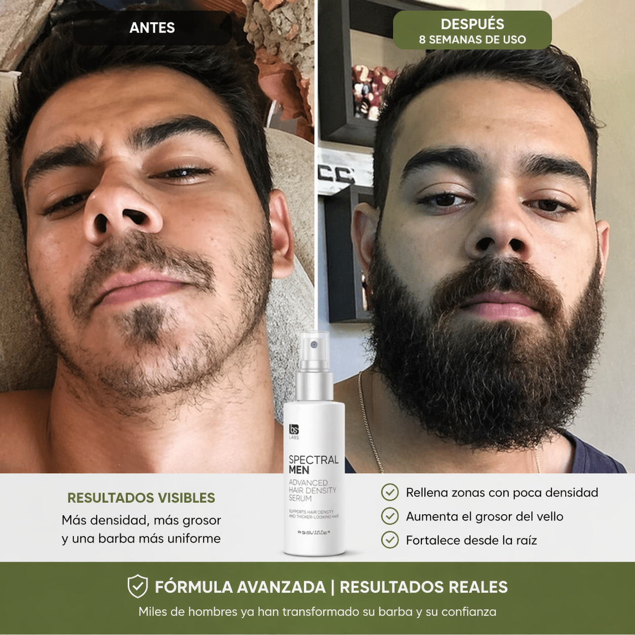 SERUM SPECTRAL | Menos caída y una barba uniforme que se nota cada vez que te miras al espejo