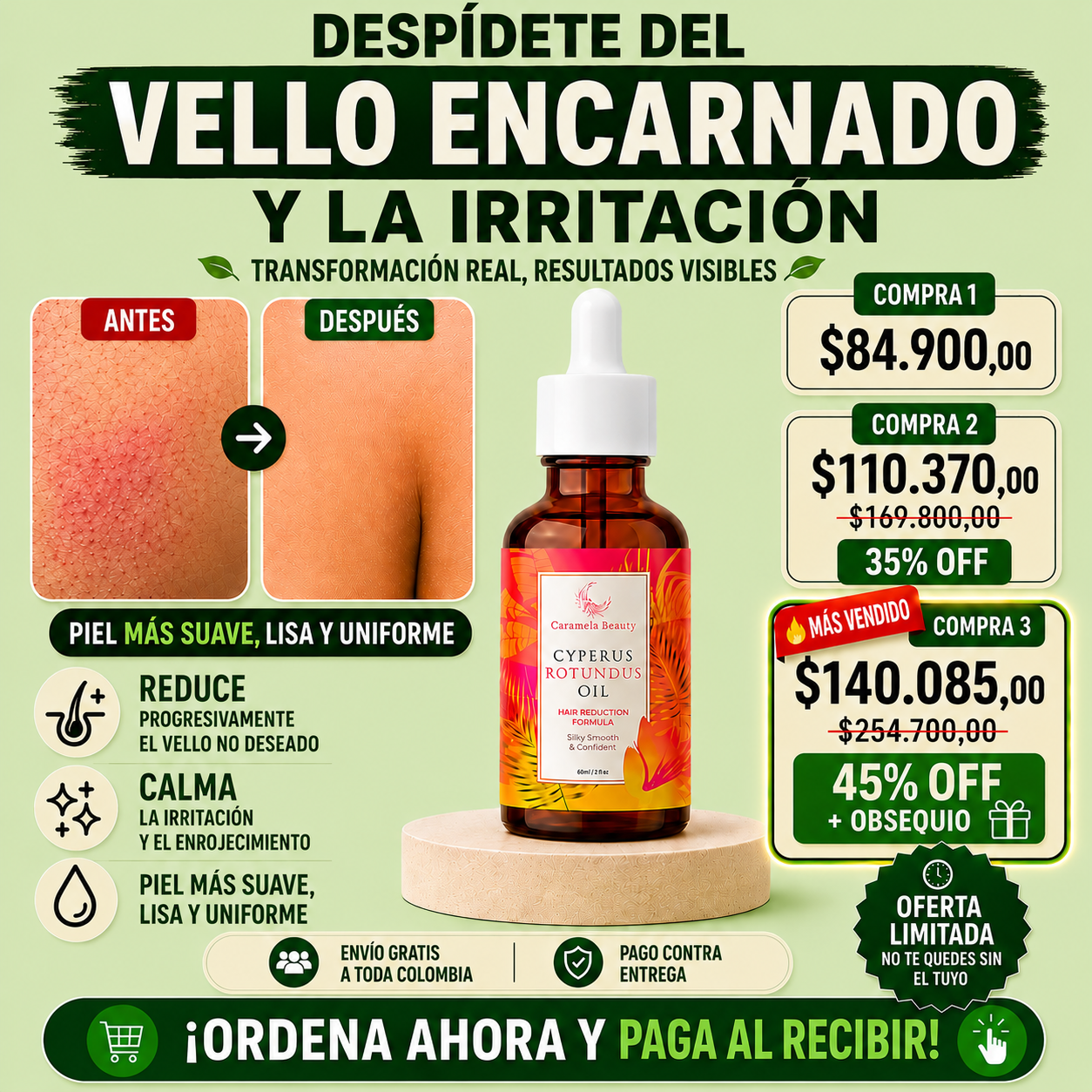 CYPERUS ROTUNDUS OIL | Reduce el vello mientras tu piel luce más clara, suave y segura